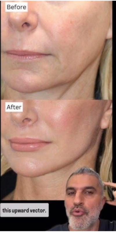 Surgical & Injectable Complications (what surgeons know from the data)